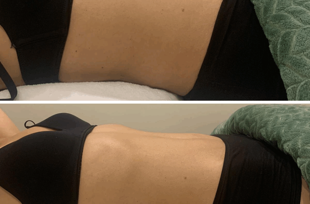 Drainage lymphatique : pourquoi votre corps en a particulièrement besoin au changement de saison