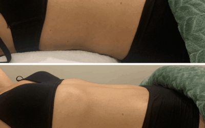 Drainage lymphatique : pourquoi votre corps en a particulièrement besoin au changement de saison