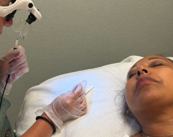 épilation electrolyse chez maeva beaute