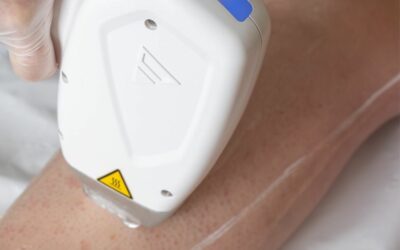 Épilation laser : ce qu&rsquo;il faut vraiment comprendre avant de se lancer